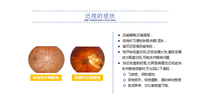 3.近视的症状.png